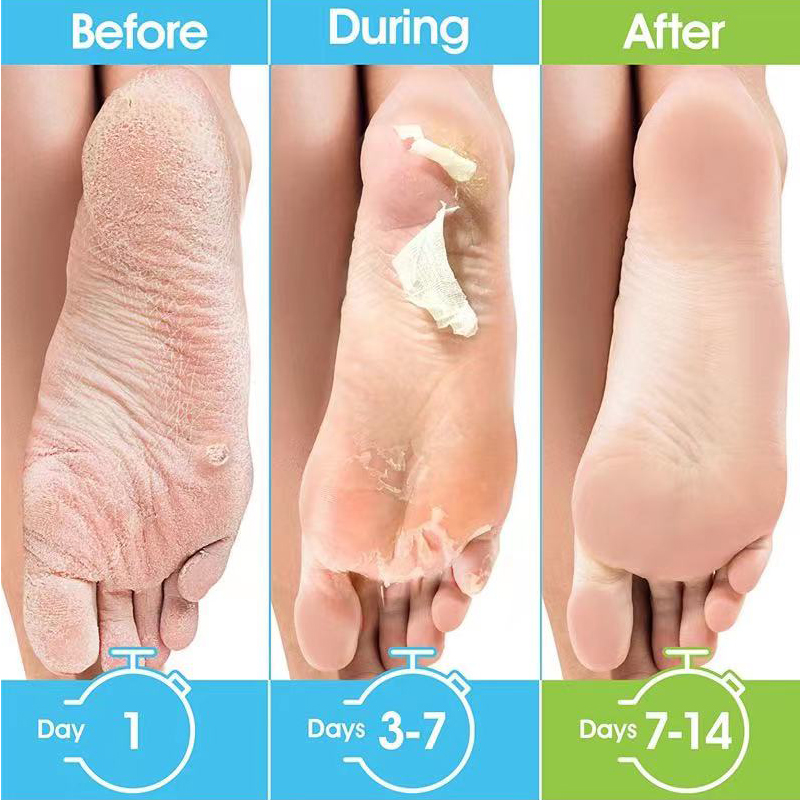 1 Pag=1 Pair Honey Foot Mask F - Foot Mask Peeling recension och pris