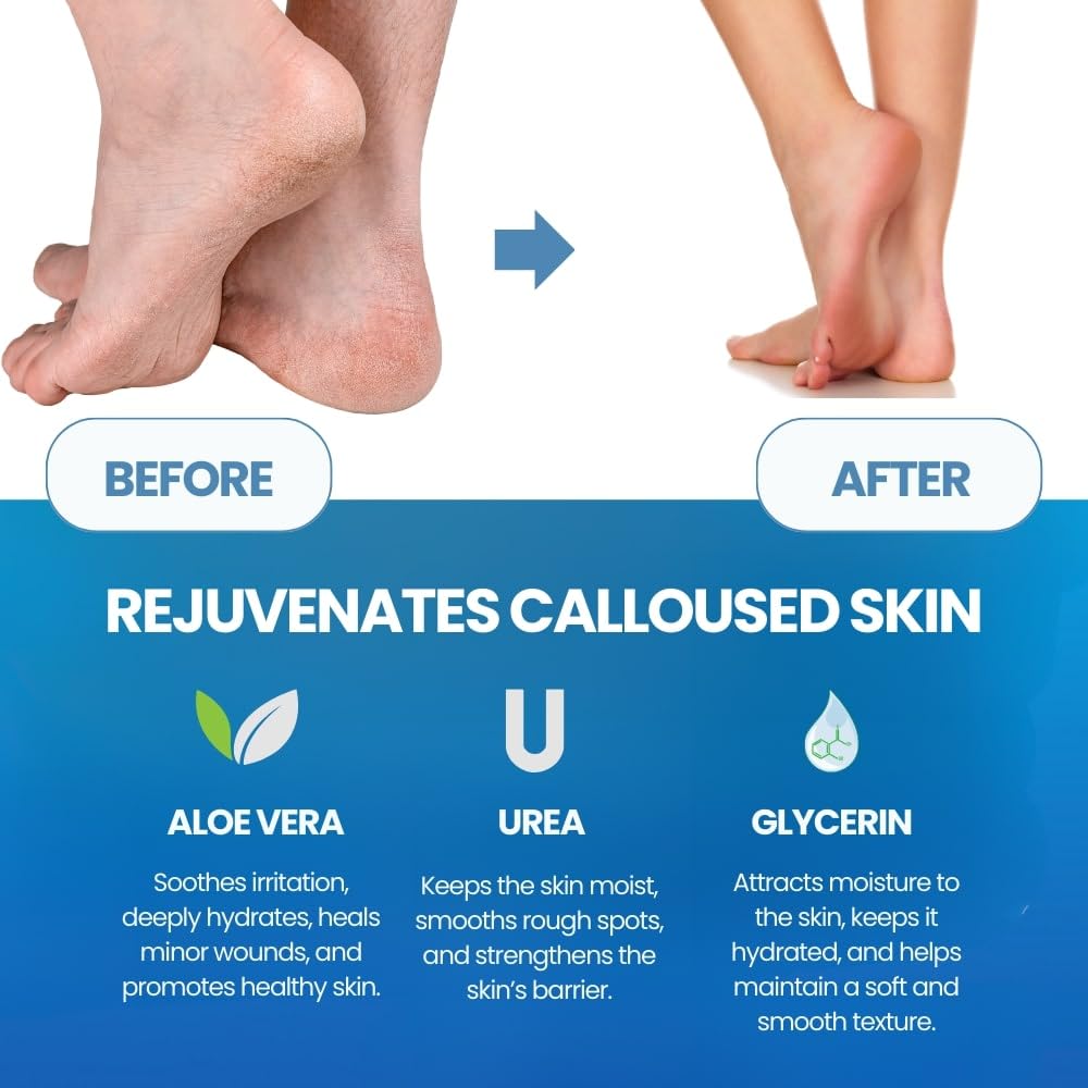 Foot Cuticle Remove Dead Foot  - Foot Mask Peeling recension och pris