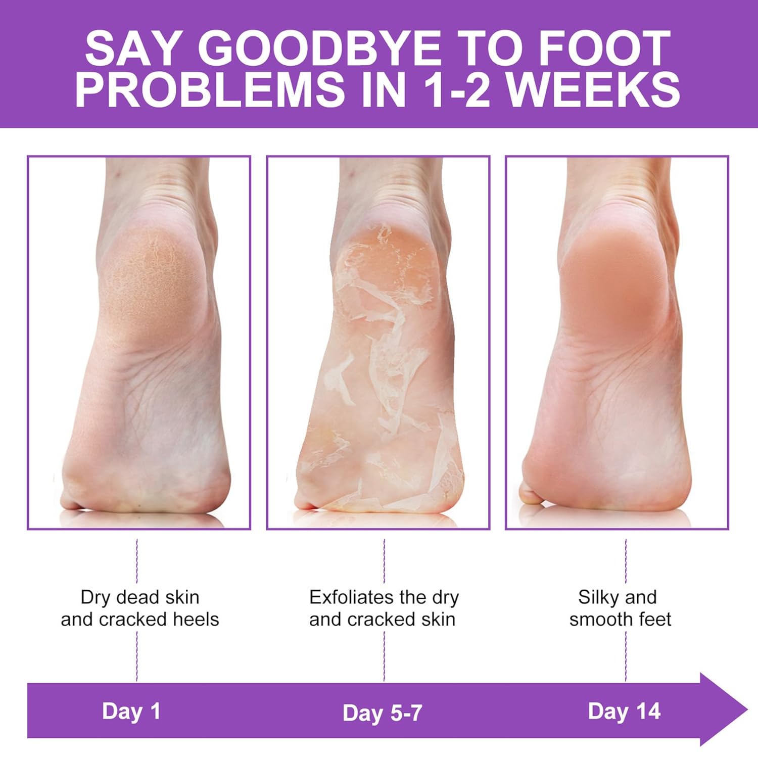 Exfoliating Peel Callus Dead S - Foot Mask Peeling recension och pris