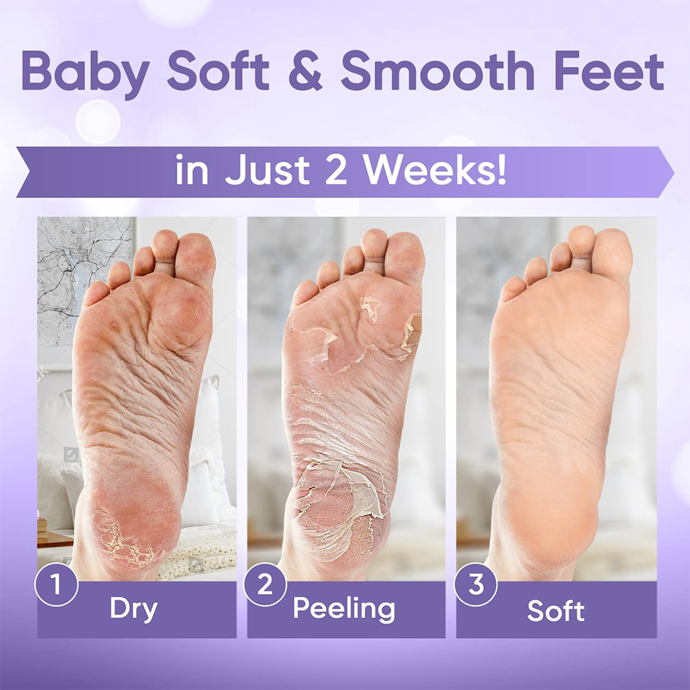 1-20Pair Exfoliating Feet Mask - Foot Mask Peeling recension och pris