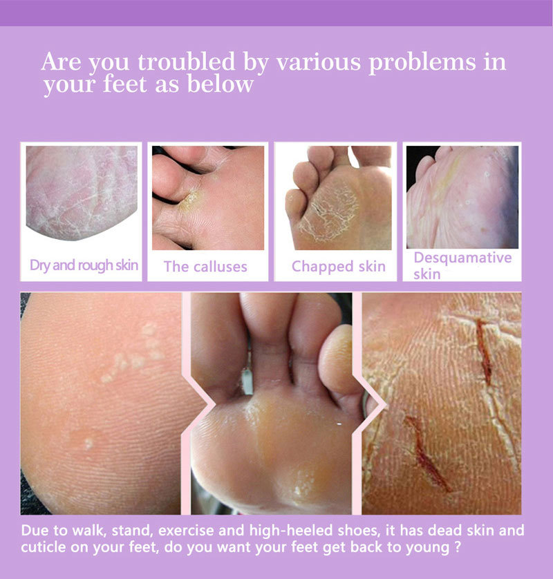 Feet Exfoliating Foot Masks Pe - Foot Mask Peeling recension och pris