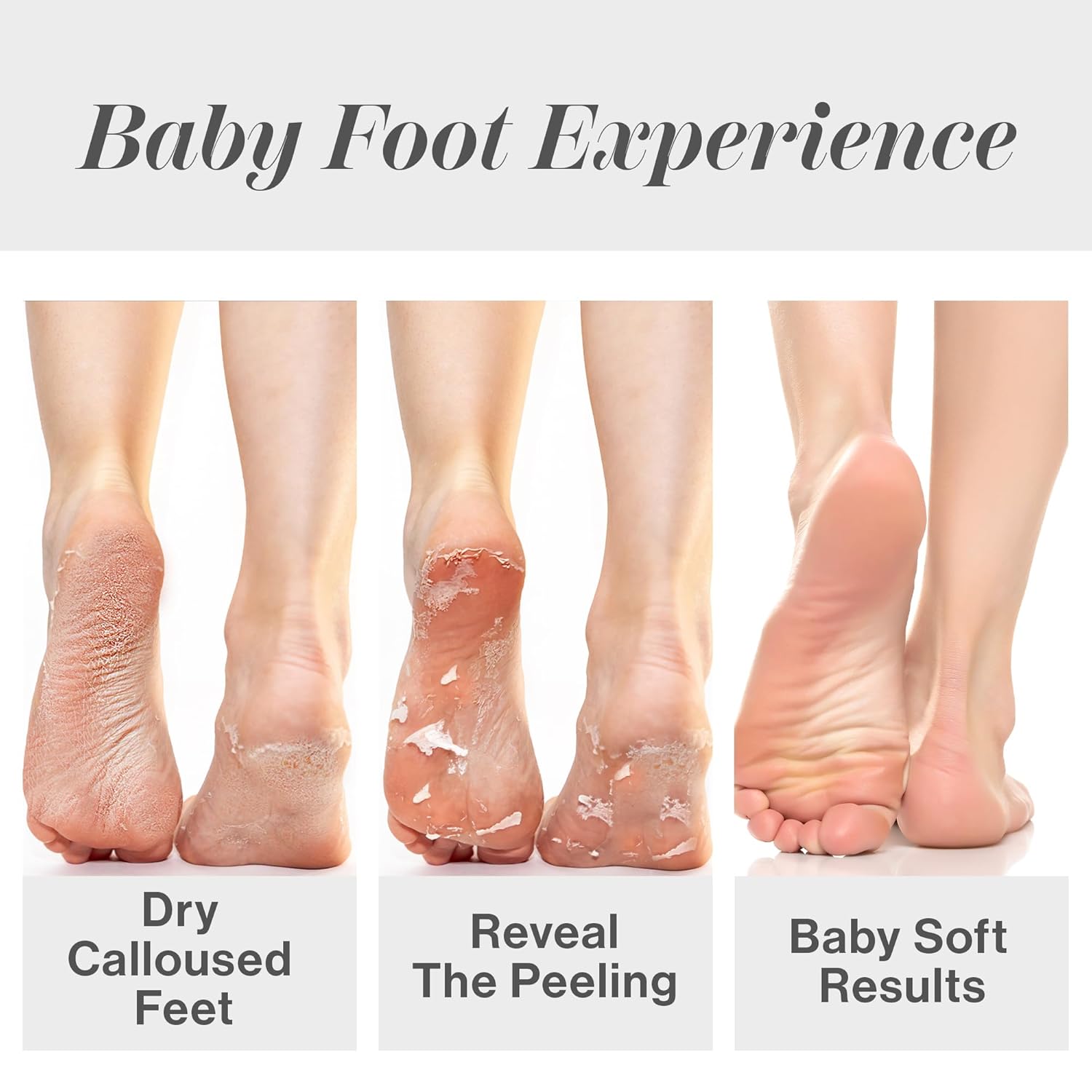 Exfoliating Peel Callus Dead S - Foot Mask Peeling recension och pris